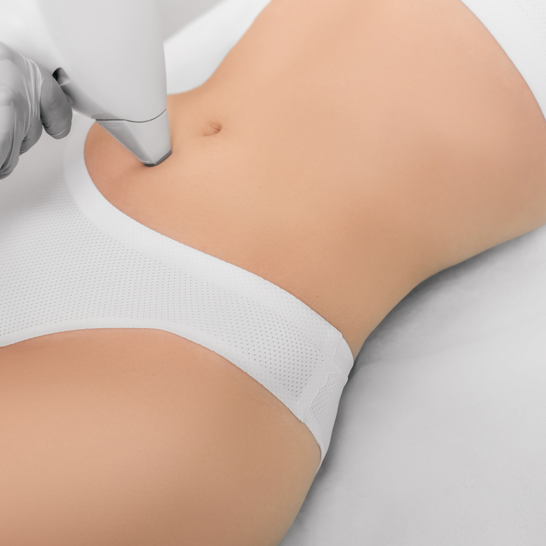 Abdomen Laser Luxe